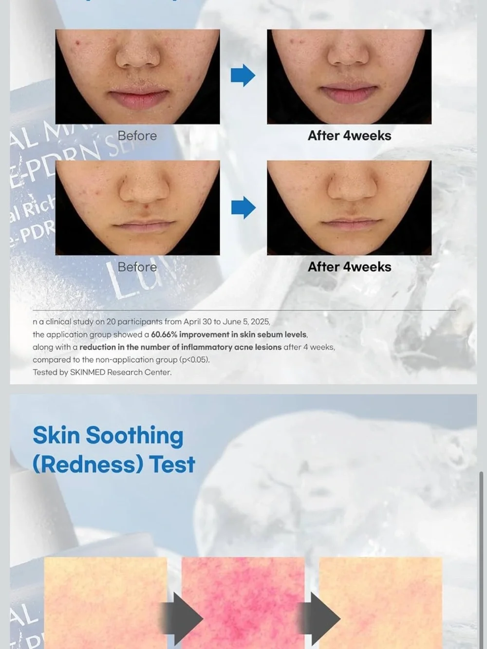 Glacial Marine Algae-PDRN Serum